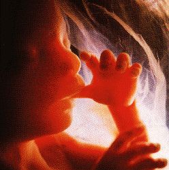 Gruppenavatar von Abtreibung ist nicht nur eine Sache zwischen Mutter und Arzt! Das KInd wird dabei nicht gefragt?