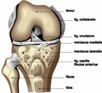 Meniskusgeschädigte