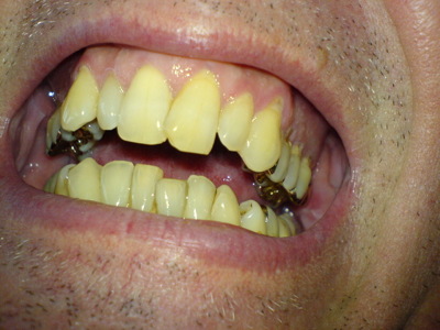 Gruppenavatar von Schöne Zähne hast Du, gibt's die auch in weiß