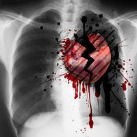 Gruppenavatar von BroKen HearTS!!