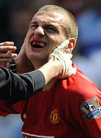 "I don´t think about getting hurt. I do what I have to do" (Nemanja Vidic)