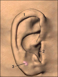 Bekomme bei manchen Leute einen Ohren-Tumor