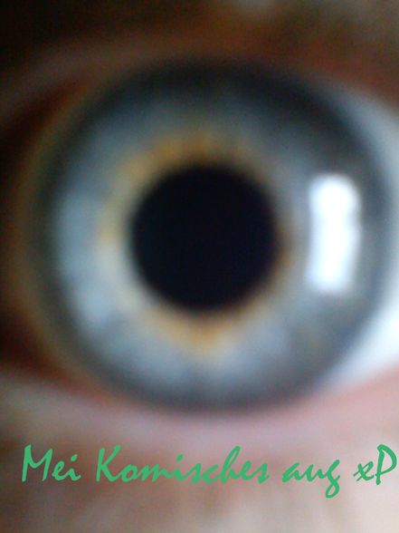 my strange eye O.o  - 