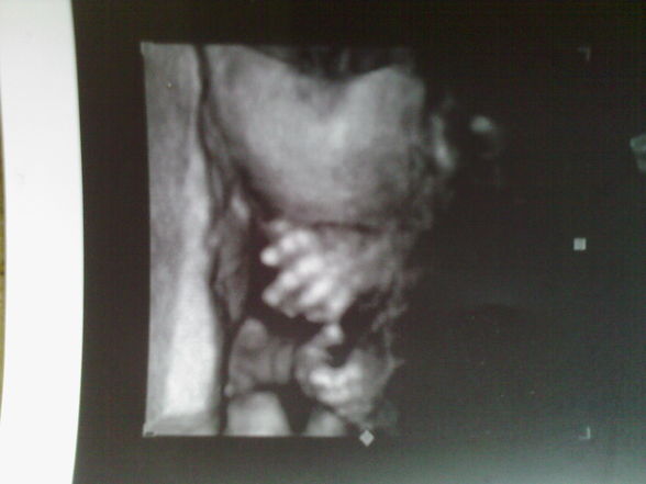 First Pics from our Baby! - 