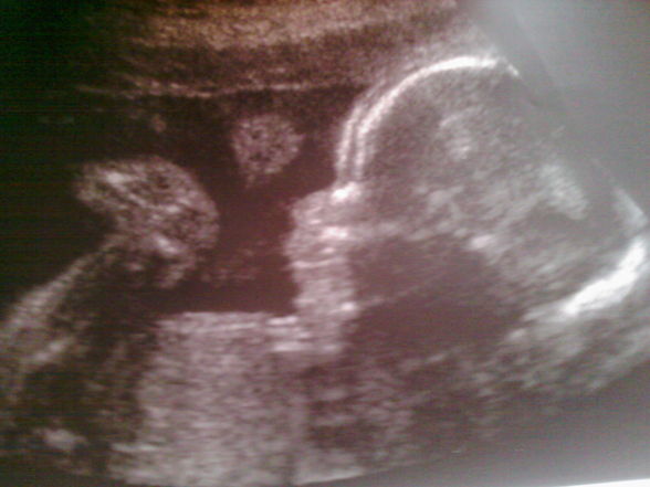 First Pics from our Baby! - 