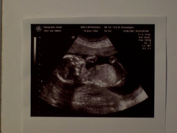 Babybauch und Ultraschallbilder - 