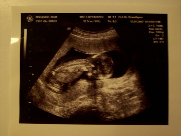 Babybauch und Ultraschallbilder - 