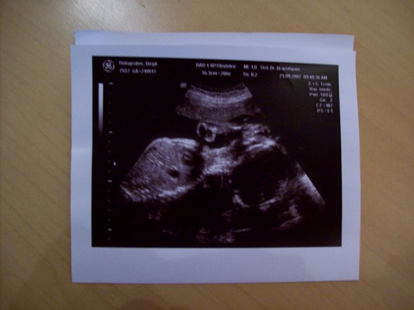 Babybauch und Ultraschallbilder - 