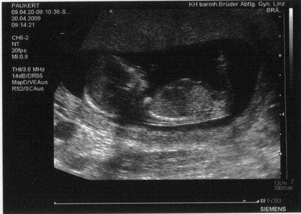 Unser Baby - 