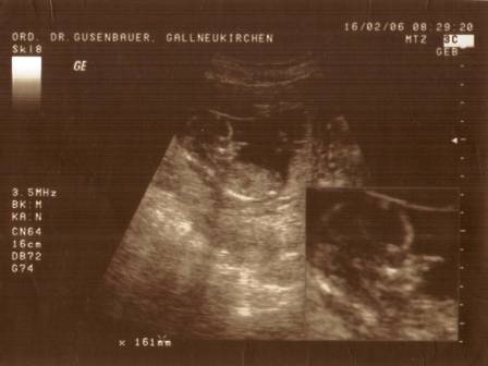 Unser Baby - 