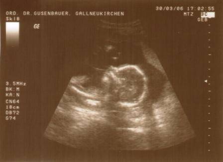 Unser Baby - 