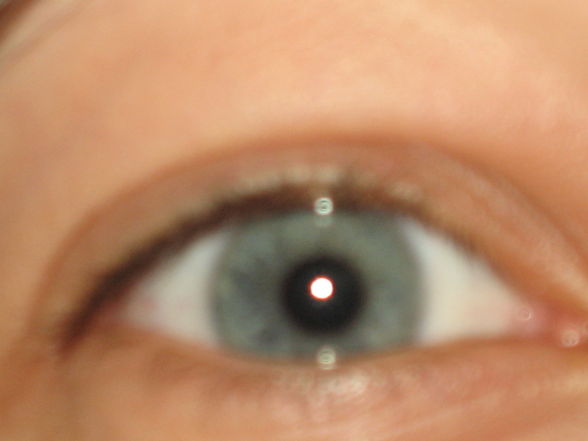 Augen von Blau bis gmischt :) - 