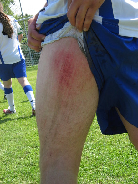 Fussballturnier 2007 - 