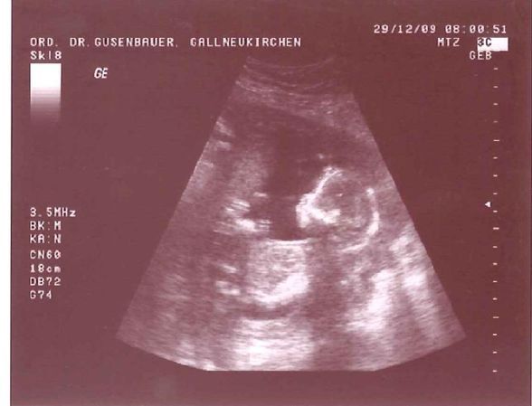 ****Unser BABY**** - 