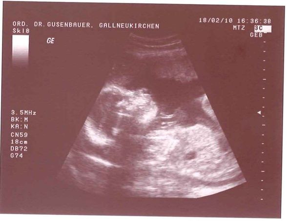 ****Unser BABY**** - 