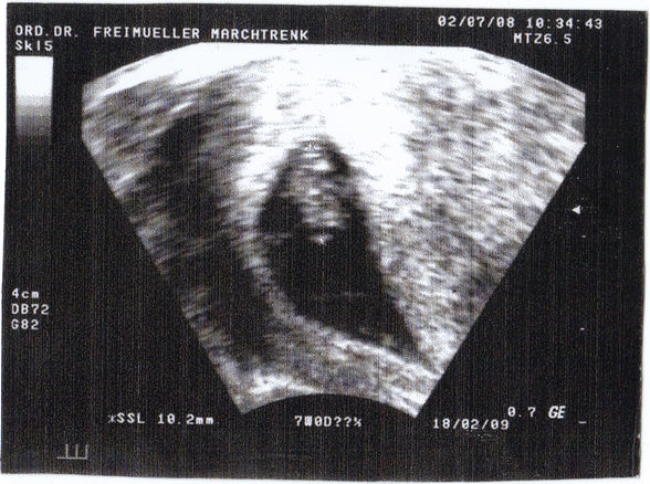 Mein kleiner Lukas - 