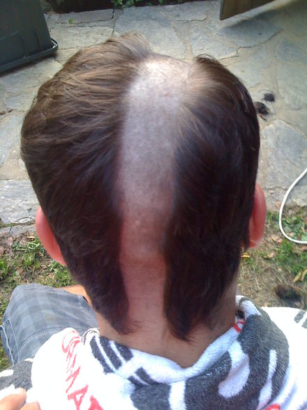 became a skinhead - 