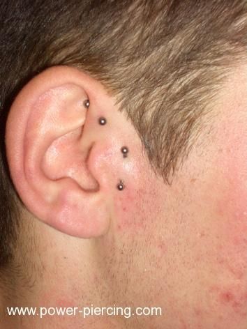 Hautpiercings & Transdermal - 