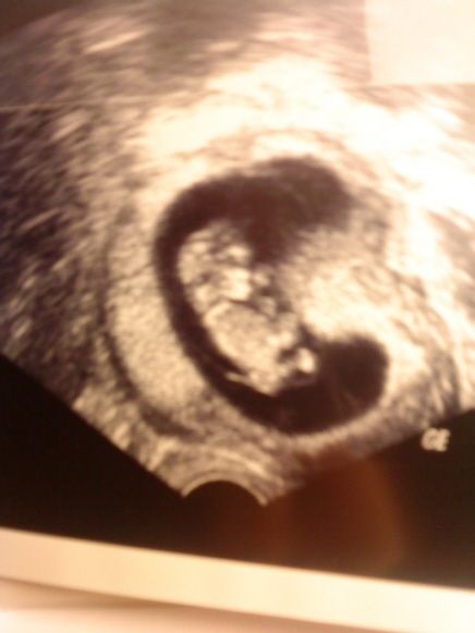 Baby nummer 2 - 