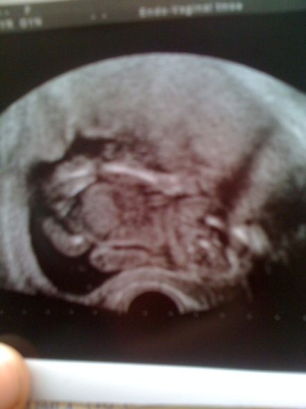 unser Baby ♥ - 