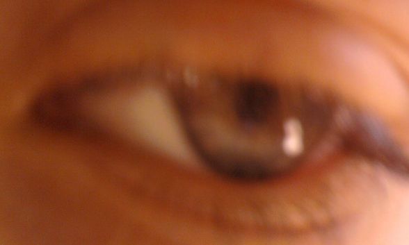 °Augen° - 