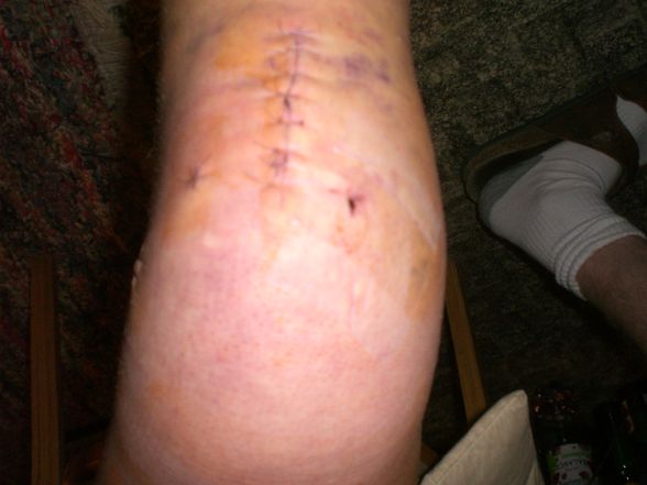 Knie - 