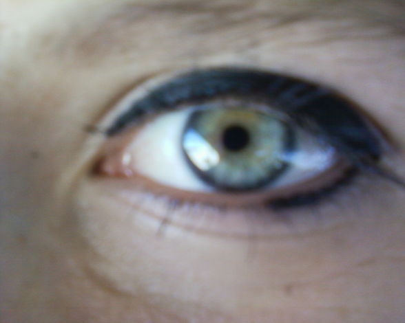 Auge - 