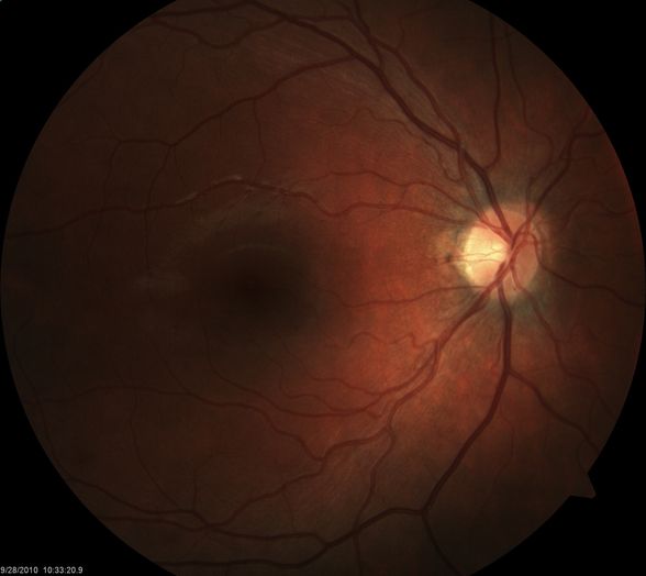 My retina photo - 