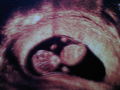 First Pics from our Baby! 42247702