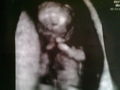 First Pics from our Baby! 42247708