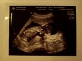 Babybauch und Ultraschallbilder 27718860