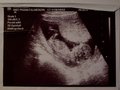 Babybauch und Ultraschallbilder 27718892