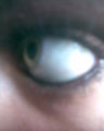 mY eYeS 63509361