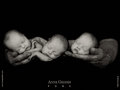 Anne Geddes 29336512