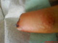 mein finger 34819333