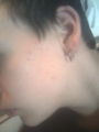 Meine Piercing 52122800