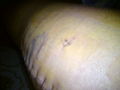 Mein KNIE..!! 74264119