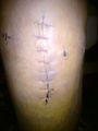 Mein KNIE..!! 74264131