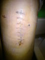 Mein KNIE..!! 74264140