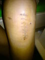 Mein KNIE..!! 74264146