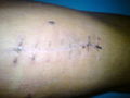 Mein KNIE..!! 74353909