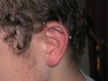 Helix/Tragus/Industrial etc. 54251611