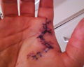 mei hand 8.11.09 69410068